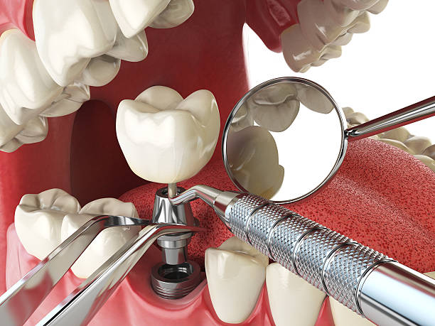 Best Emergency Denture Repair in Parrish, AL